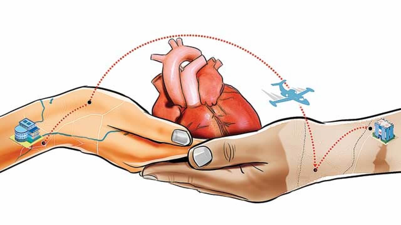 Heart Transplant